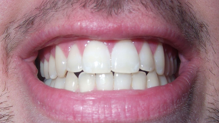 Un centre dentaire de Trappes soupçonné de fraude